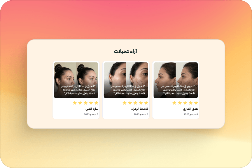 آراء العملاء (Social Proof)